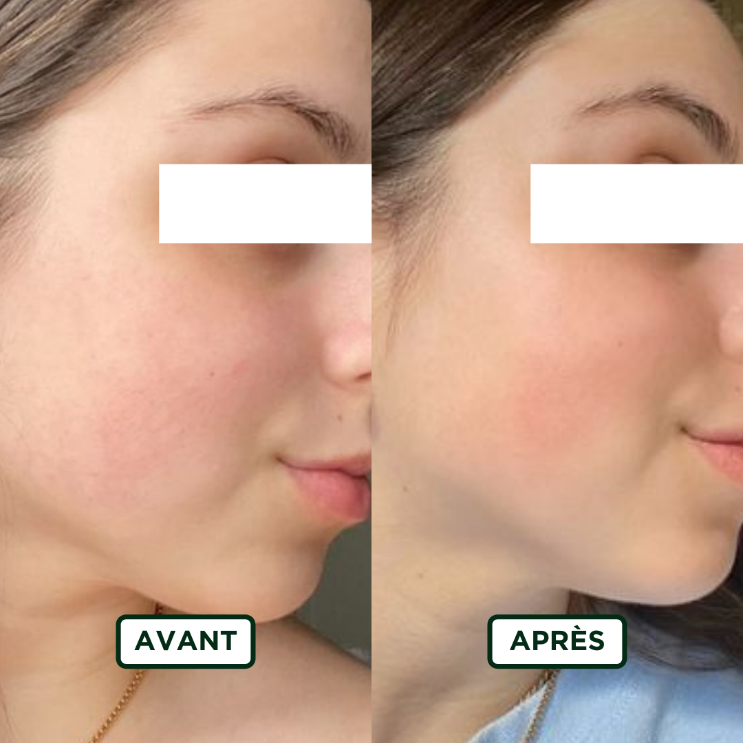 Sérum à l’Acide Hyaluronique Personnalisé